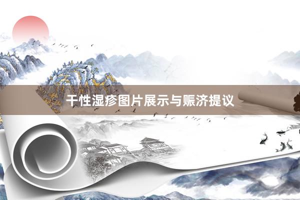 干性湿疹图片展示与赈济提议